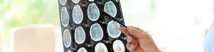 Traumatic Brain Injury Lawyer in Beaufort
